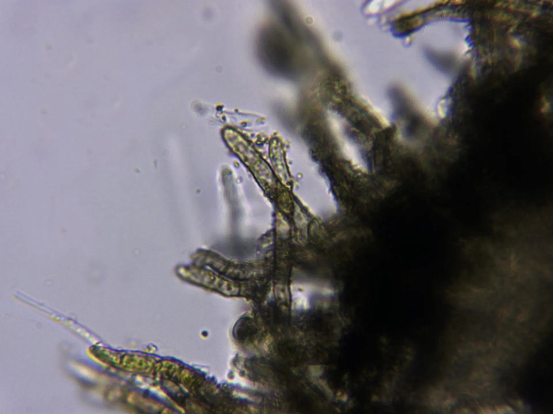Microscopía de Neodasyscypha cerina - 12 - Pelos agua 2